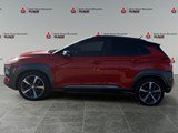 2018 Hyundai Kona 1.6T Trend (DCT)
