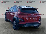2018 Hyundai Kona 1.6T Trend (DCT)